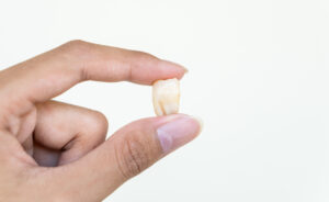 Hand holding old removed wisdom tooth from kid mouth isolated on white background, dentist found unhealthy damaged teeth cause toothache at dentistry hospital