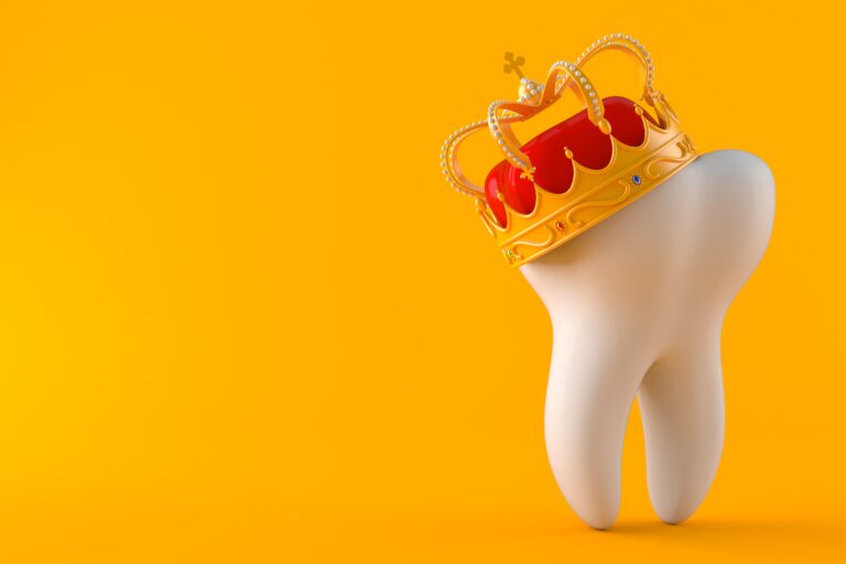 Situations Where Crowns Can Help Cedar Dental