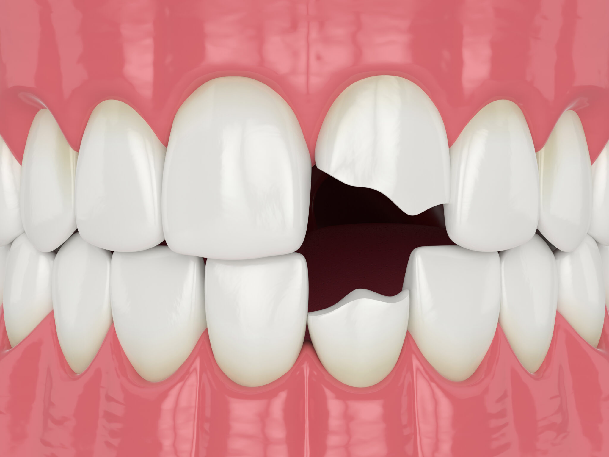 Addressing Unsightly Smile Blemishes Cedar Dental